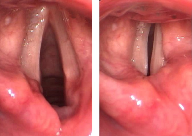 pharynx inside the throat