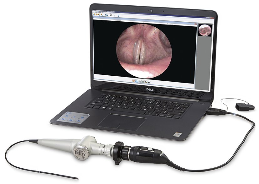 Mobile FEEs procedure of throat performed on laptop